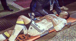 VIDEO - Van Persie infortunio shock: il calciatore ha rischiato di perdere la vista