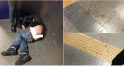 FOTO - Tifoso del Napoli pestato a sangue a Istanbul! Immagini bruttissime