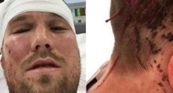 CLAMOROSO - Campione del mondo con la Germania lascia il calcio dopo una rissa!